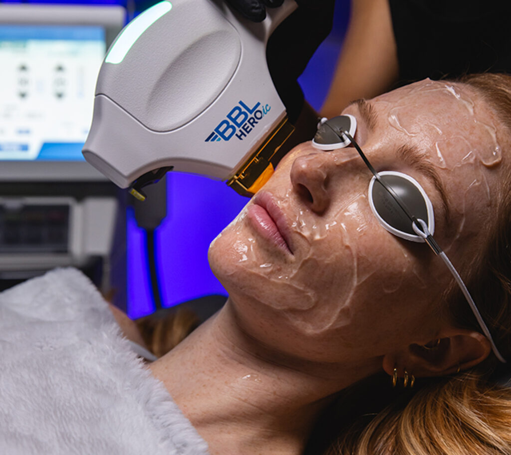MOXI Laser & Forever Young BBL® Therapie in Zofingen